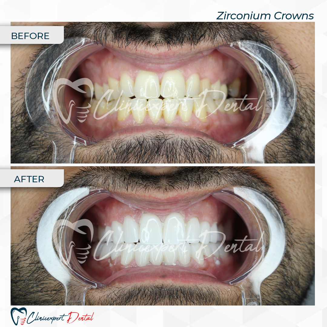 Clinicexpert Dental Clinicexpert Dental