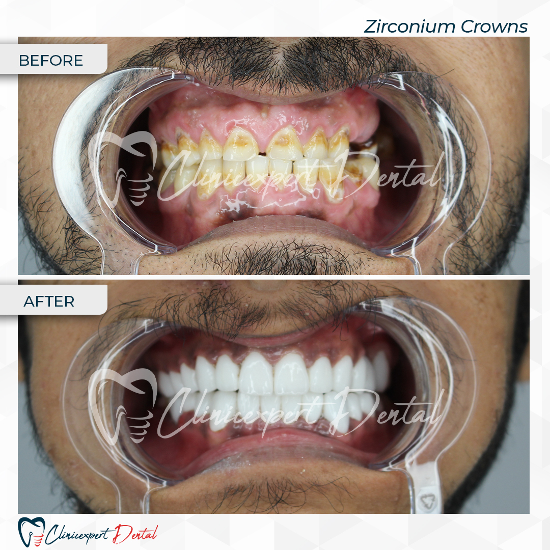 Clinicexpert Dental Clinicexpert Dental