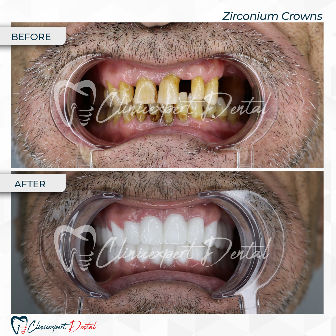 Clinicexpert Dental Clinicexpert Dental