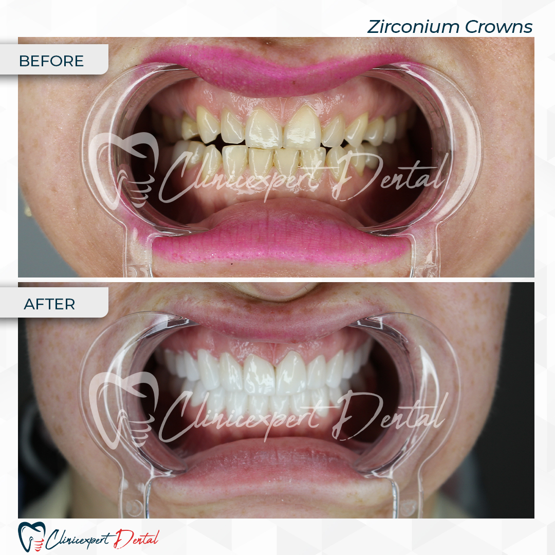 Clinicexpert Dental Clinicexpert Dental