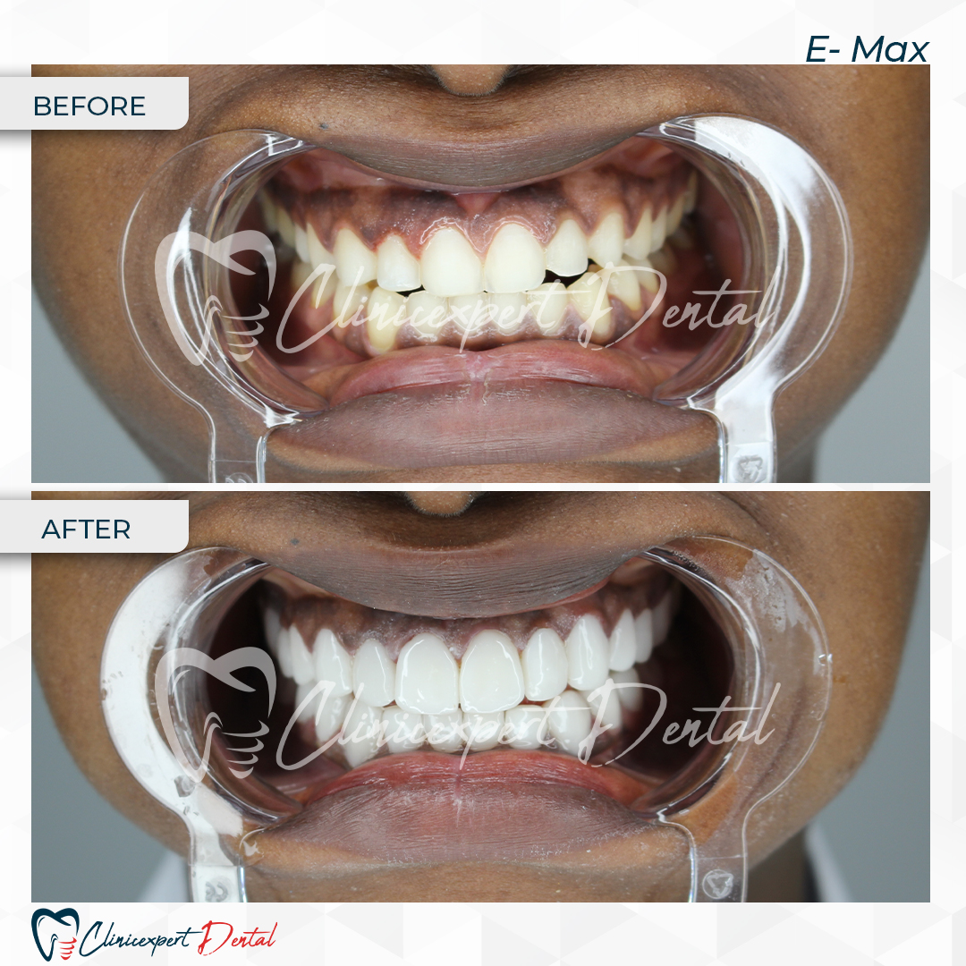 Clinicexpert Dental Clinicexpert Dental