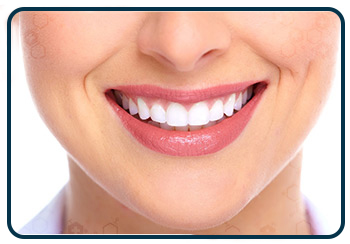 Embellissement des Dents